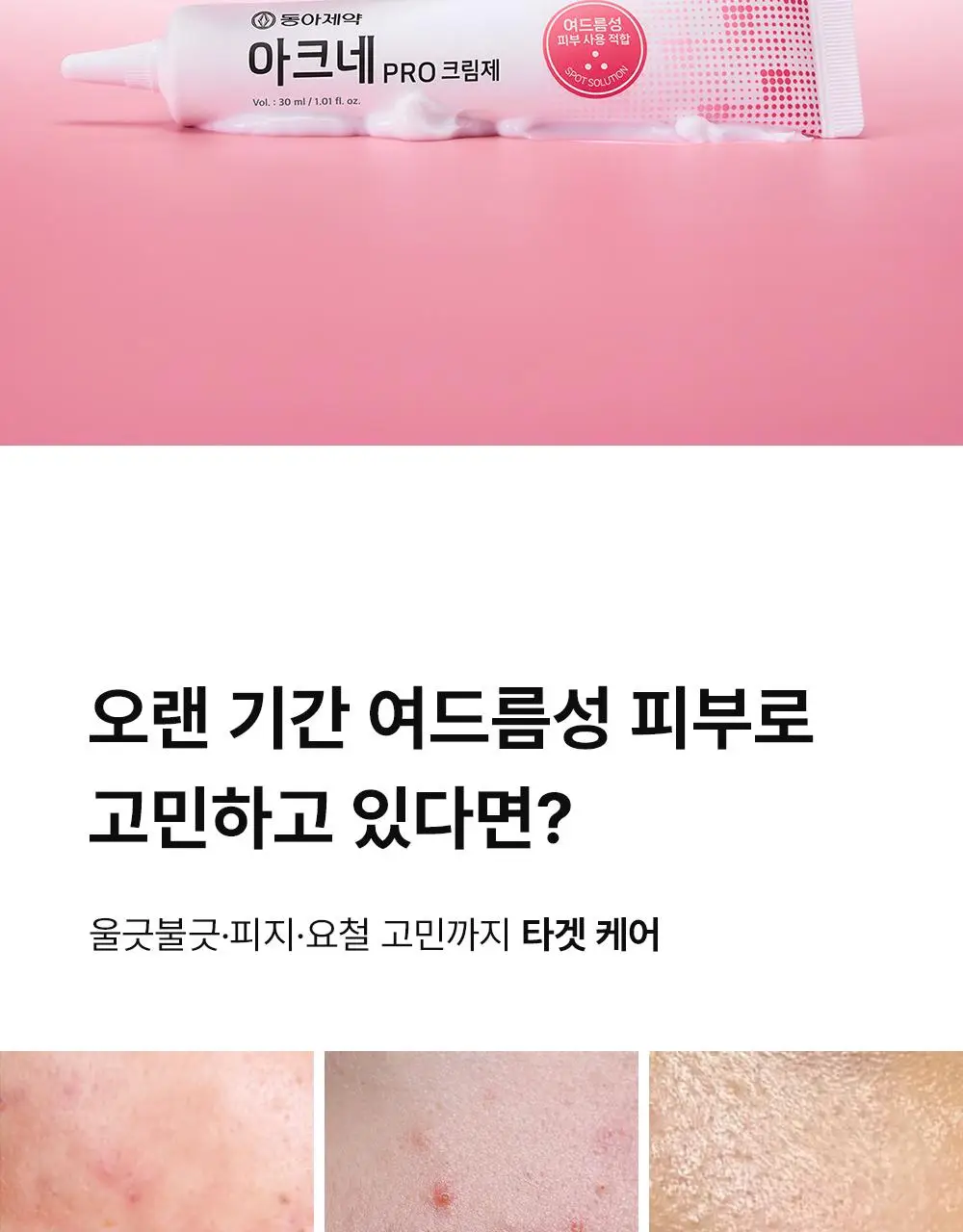 (하루특가)[단독기획] 동아제약 아크네 프로 크림제 30ml 기획(+3ml+겔제3ml) 상세페이지 7
